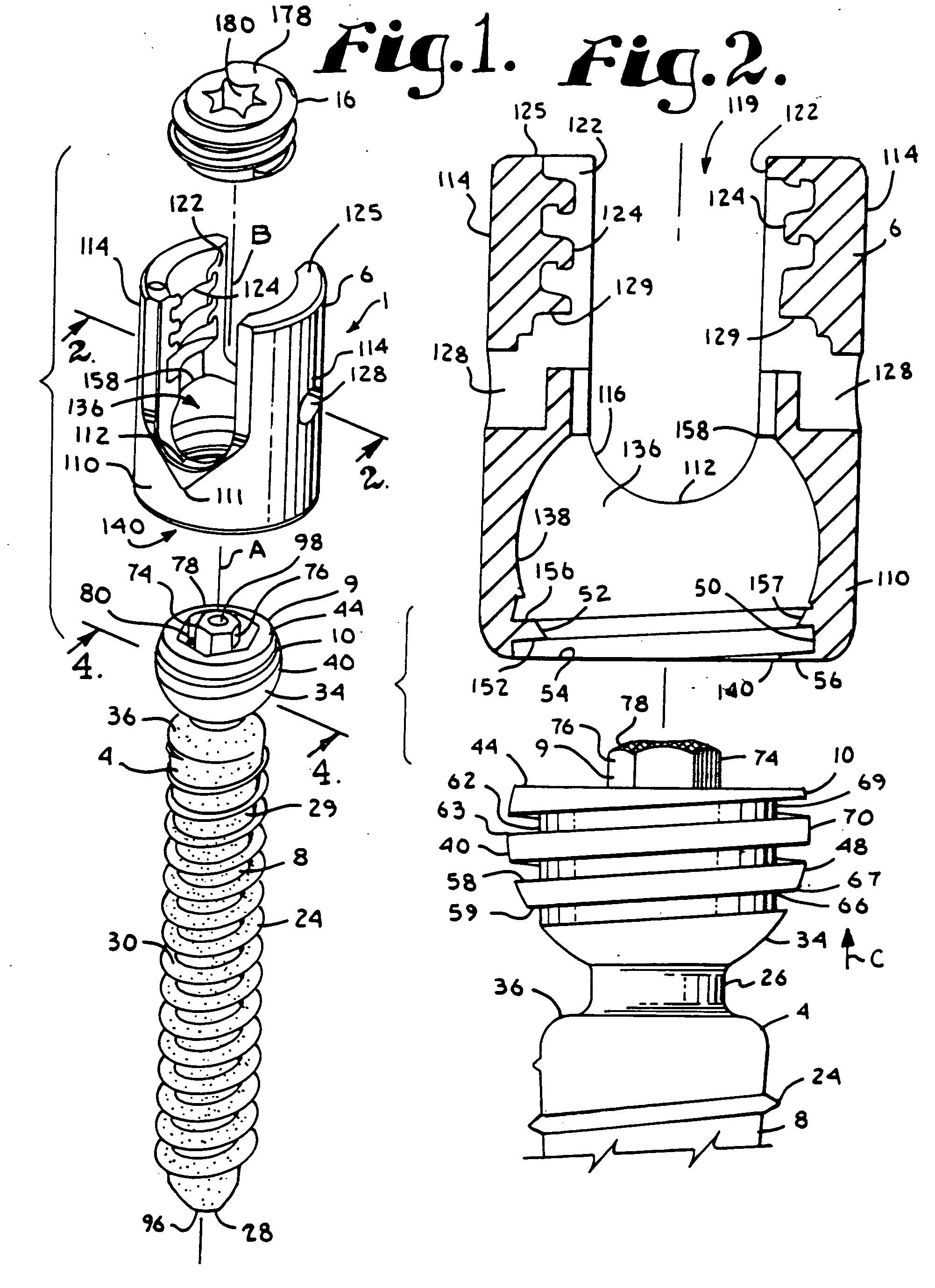 Dynamic stabilization medical implant assemblies and methods