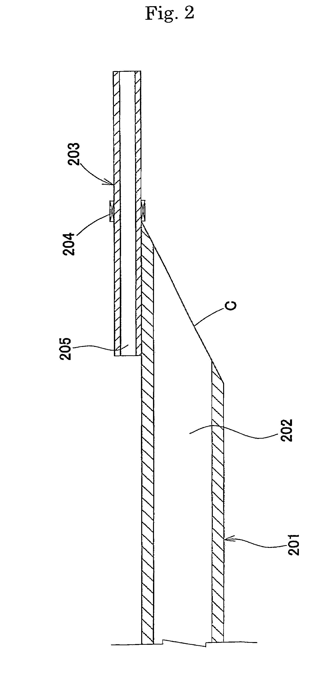 Suction catheter