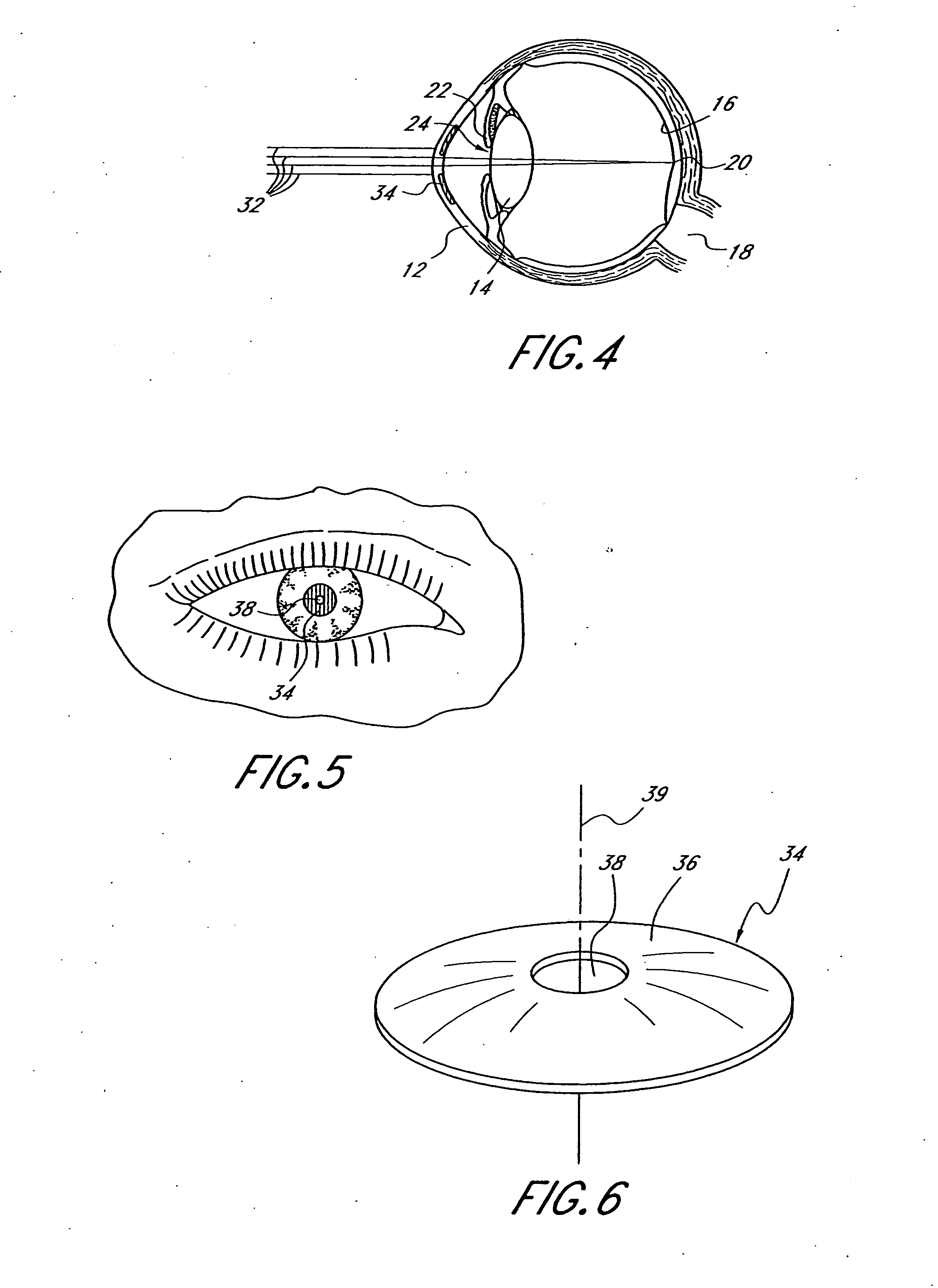 Method and apparatus for aligning a mask with the visual axis of an eye