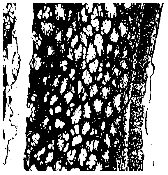 A traditional Chinese medicine composition for treating ulcerative colitis and its preparation method and application