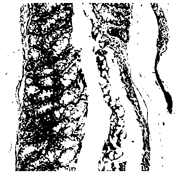 A traditional Chinese medicine composition for treating ulcerative colitis and its preparation method and application