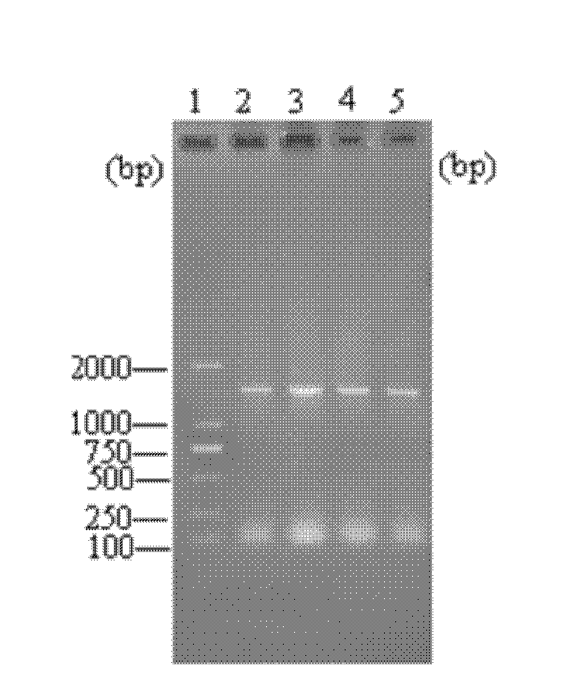 Aldehyde dehydrogenase gene, vector, engineering bacteria and application thereof