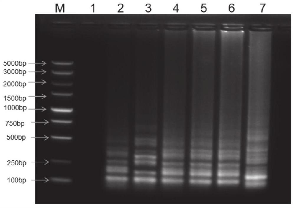 LAMP-LFD-based helicobacter pylori POCT detection kit and method