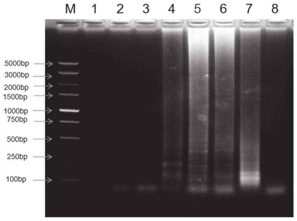 LAMP-LFD-based helicobacter pylori POCT detection kit and method