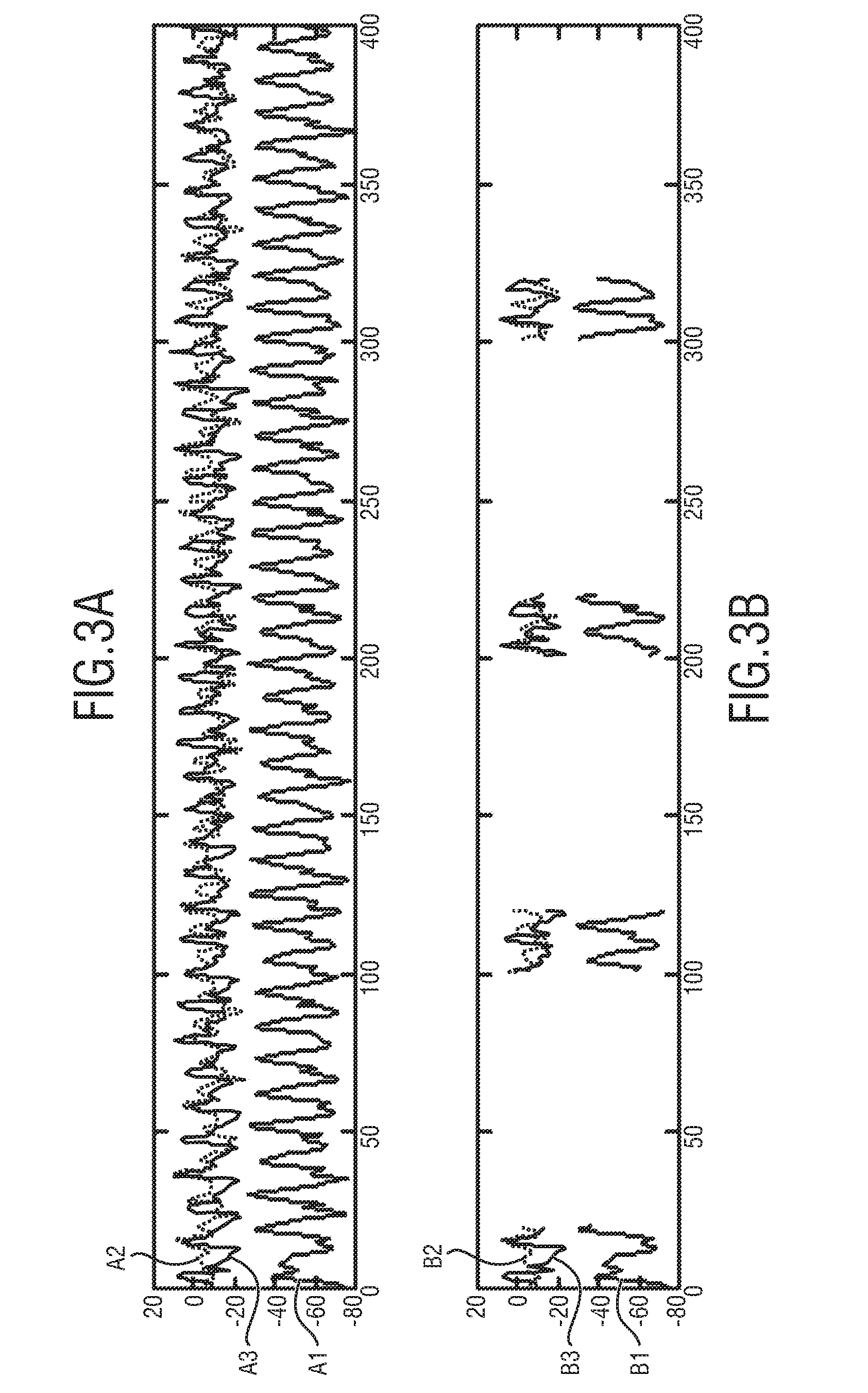 Device, method and system for counting the number of cycles of a periodic movement of a subject