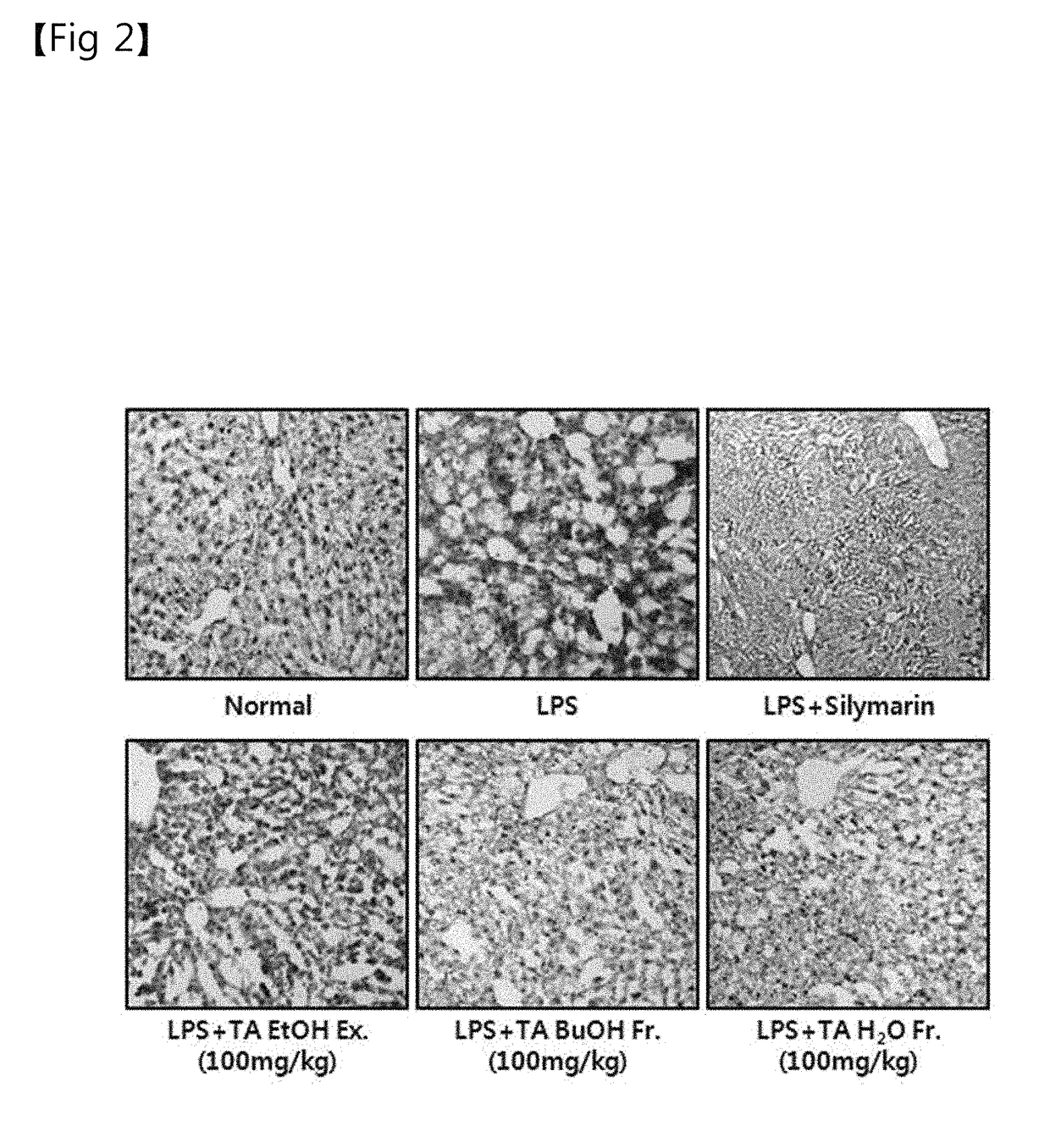 Method for preventing, improving or treating liver disease