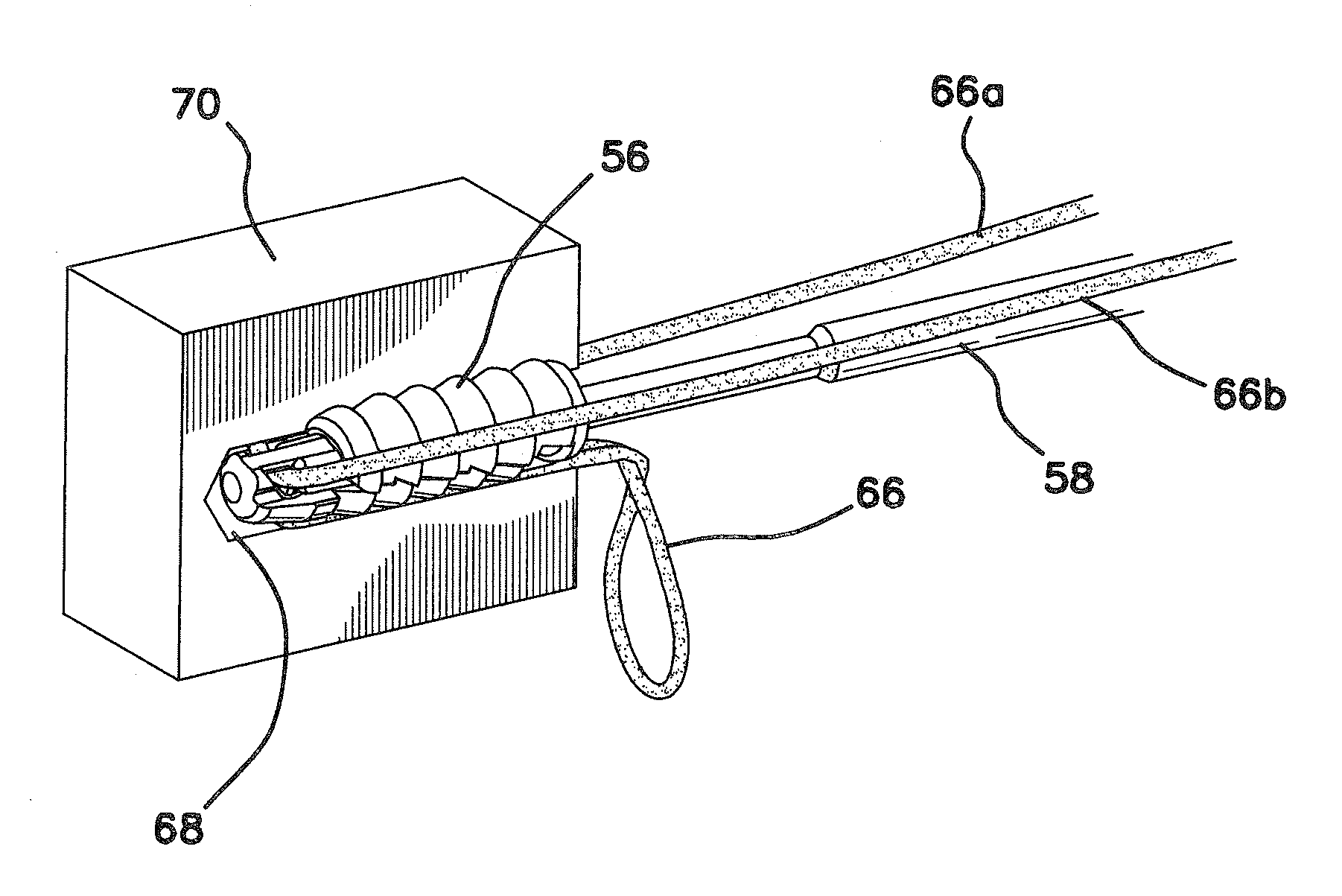 Anchors and methods for securing suture to bone