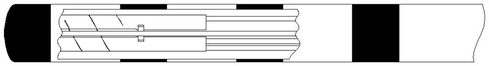 Catheter ablation system