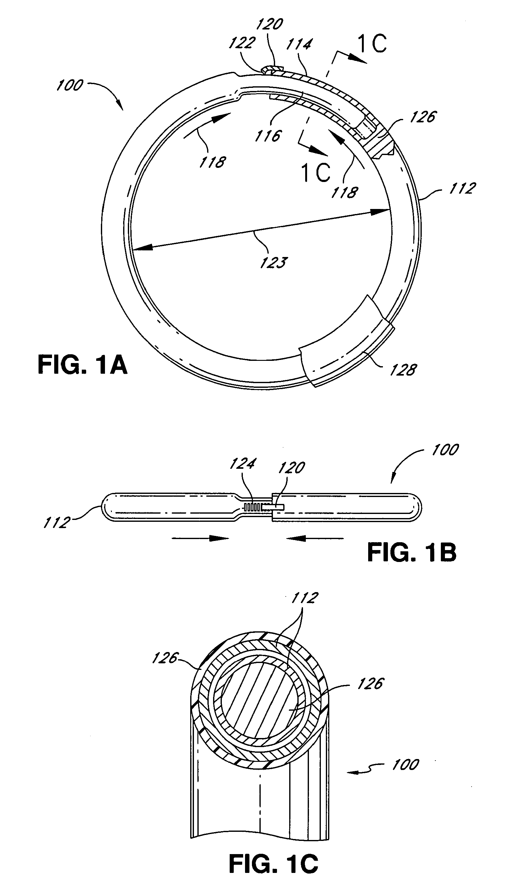 Intraoperative and post-operative adjustment of an annuloplasty ring