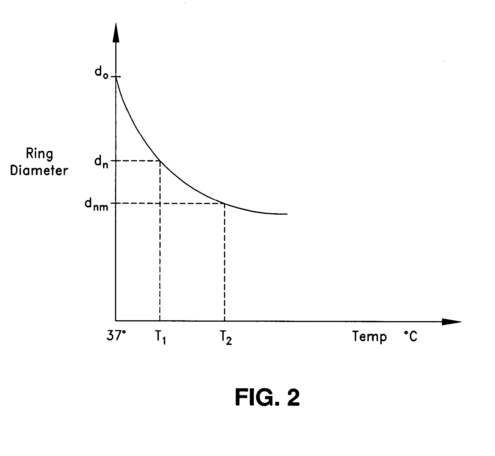 Intraoperative and post-operative adjustment of an annuloplasty ring