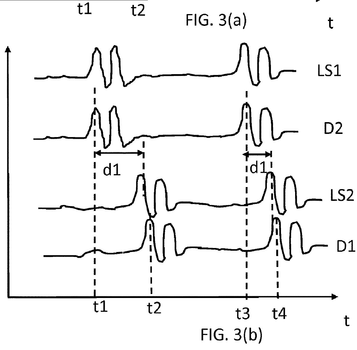A sensor system and method which makes use of multiple ppg sensors