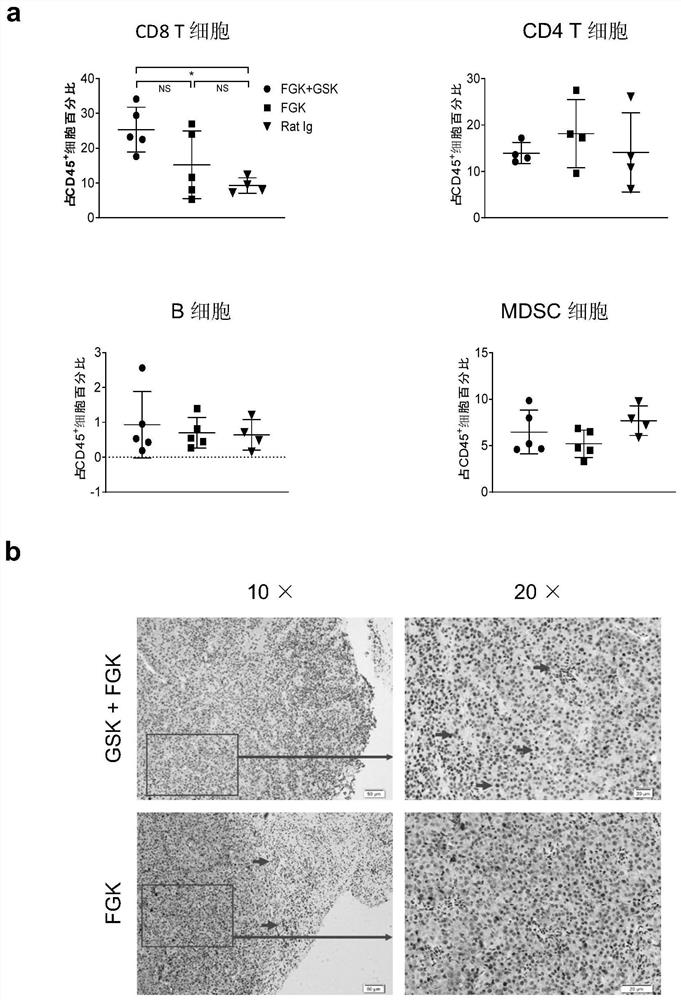 Application of PPAR delta inhibitor combined immunotherapy drug in preparation of antitumor drugs