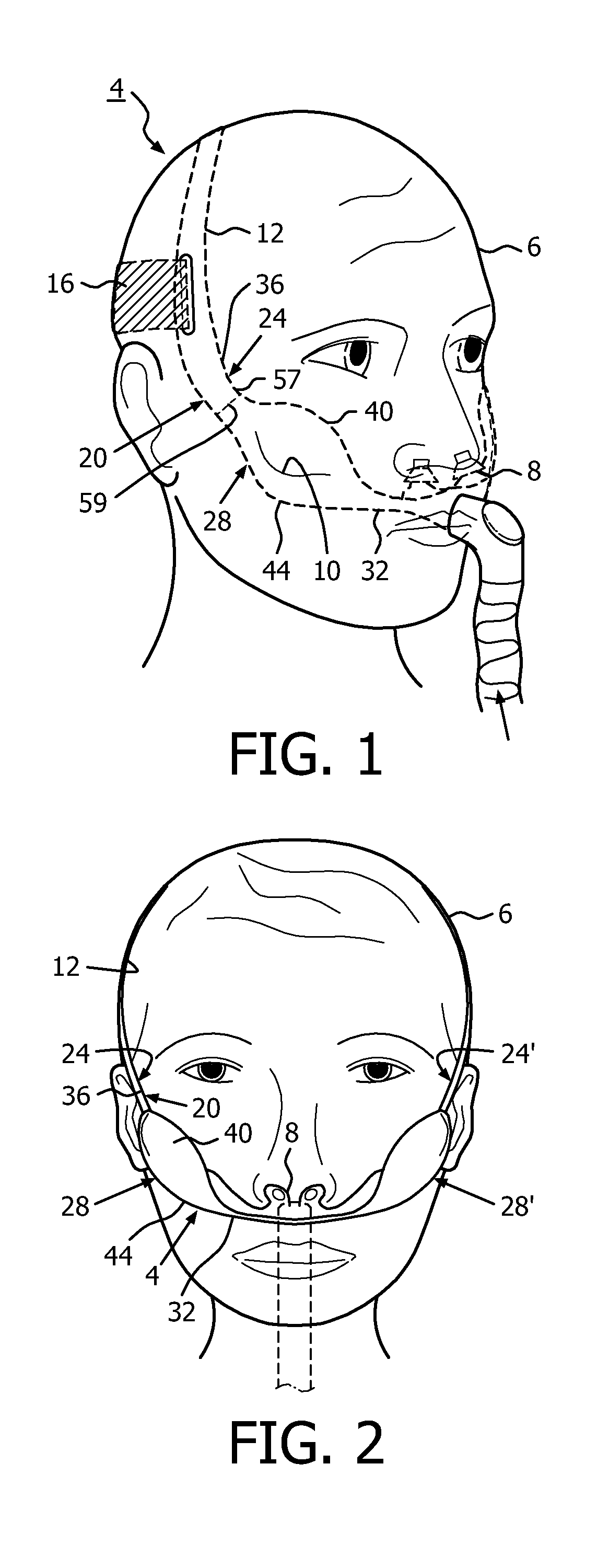 Headgear apparatus for nasal interface