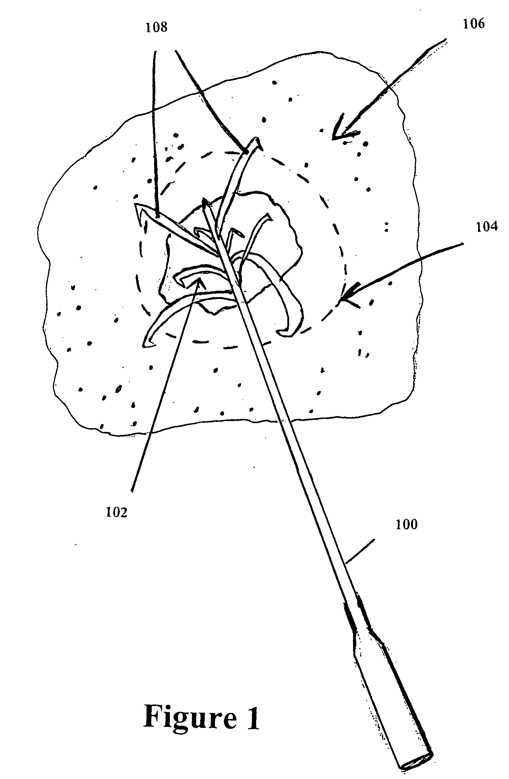 Tumor ablation in combination with pharmaceutical compositions