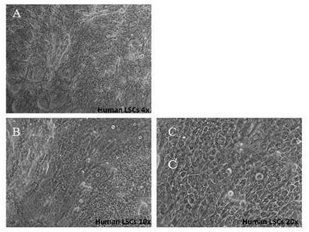 Limbal stem cell culture medium and culture method thereof