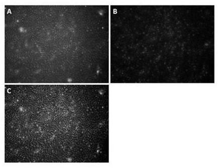 Limbal stem cell culture medium and culture method thereof