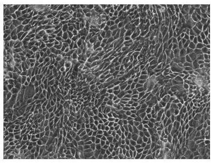 Limbal stem cell culture medium and culture method thereof