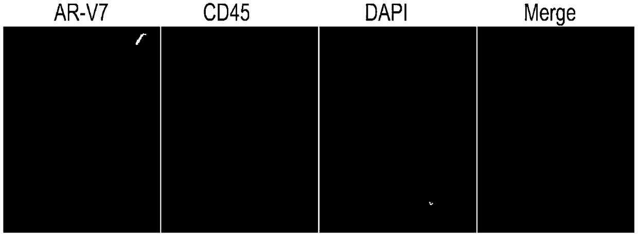 Immunofluorescence detection kit for androgen receptor splicing variant AR-V7 and application