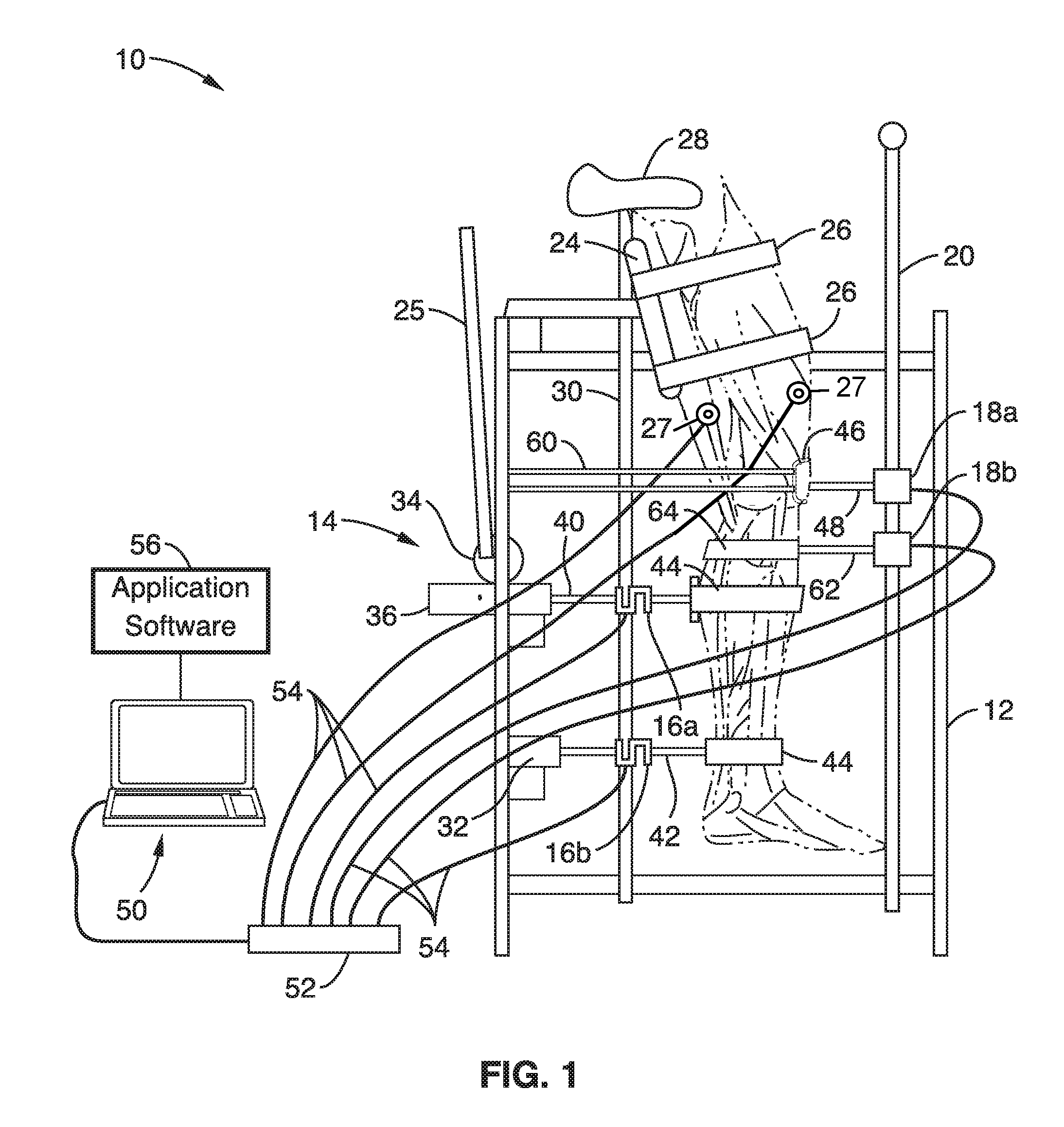 Diagnostic knee arthrometer for detecting acl structural changes