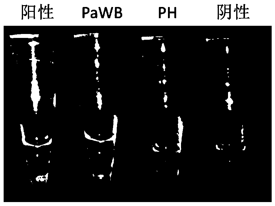 Lamp primer set for detecting phytoplasma and its kit and application