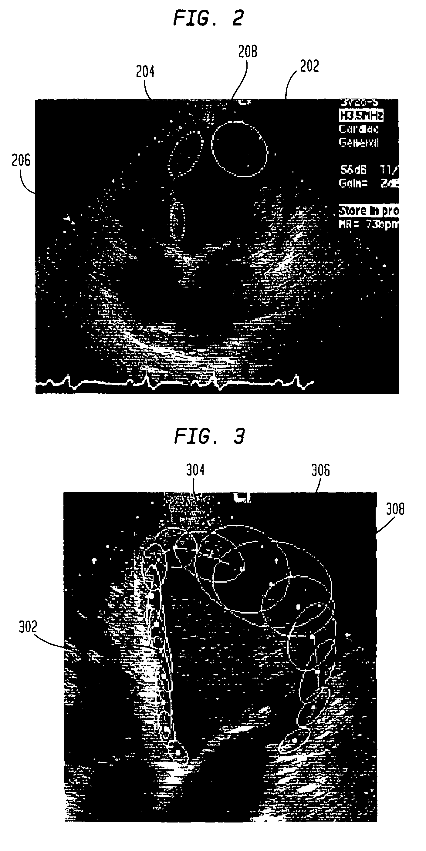 System and method for tracking a global shape of an object in motion