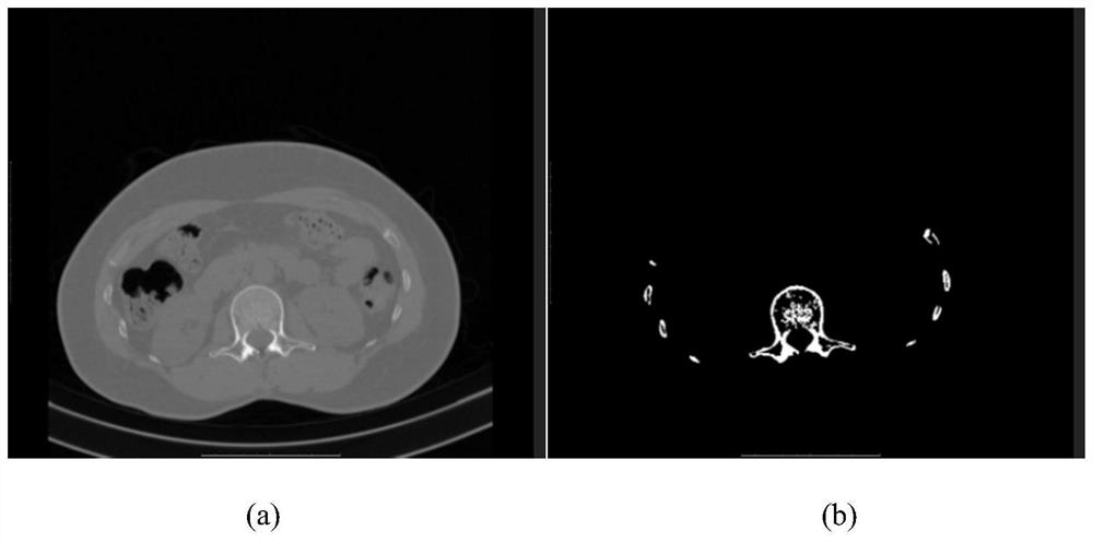 A medical image bone segmentation method based on the combination of pspnet and hed