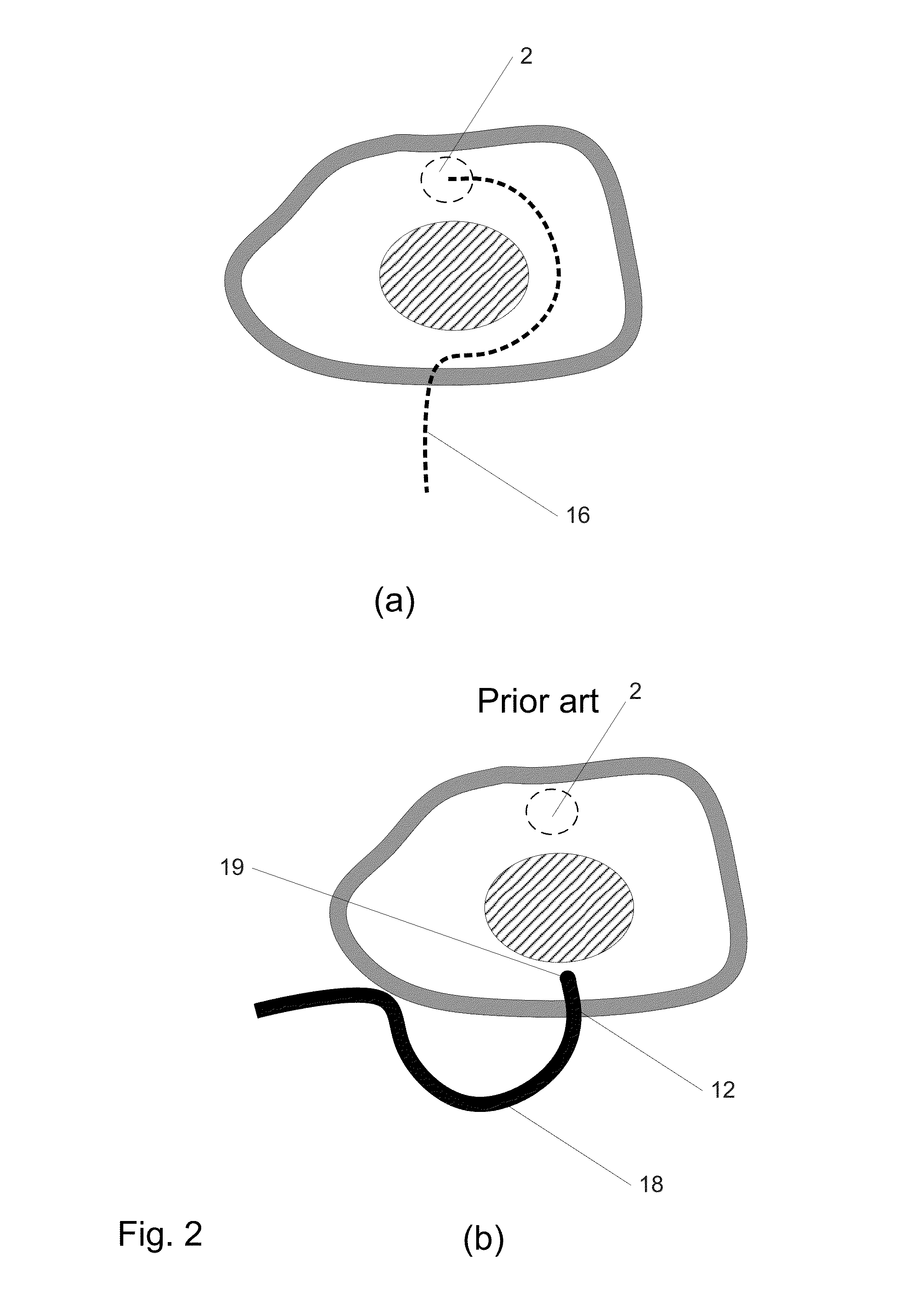 Steerable extendable devices