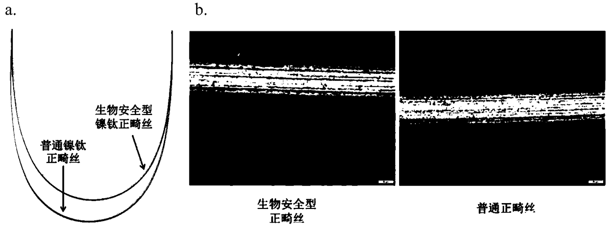 Nickel-titanium alloy medical equipment with surface coating and coating preparation method