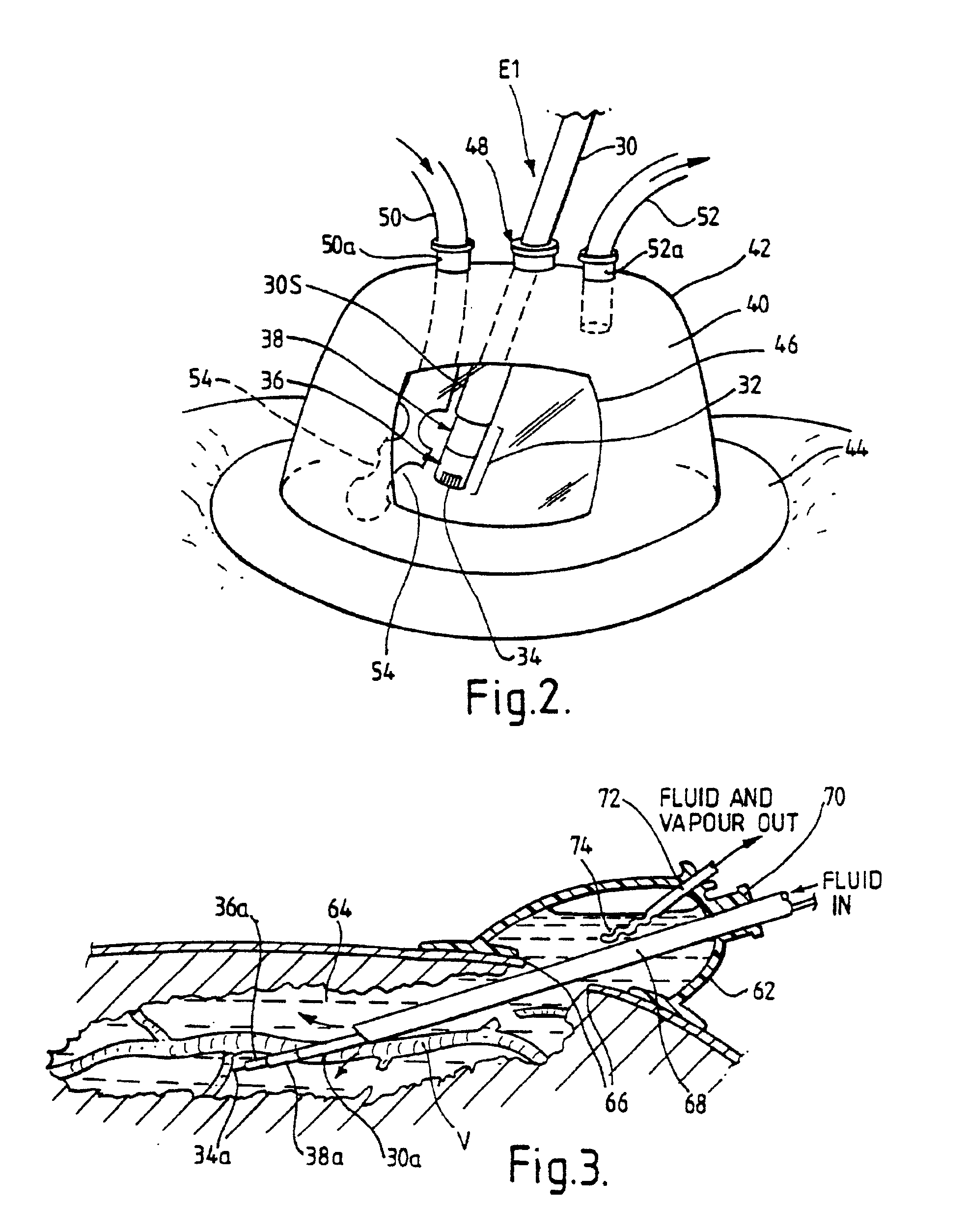 Electrosurgical system and method