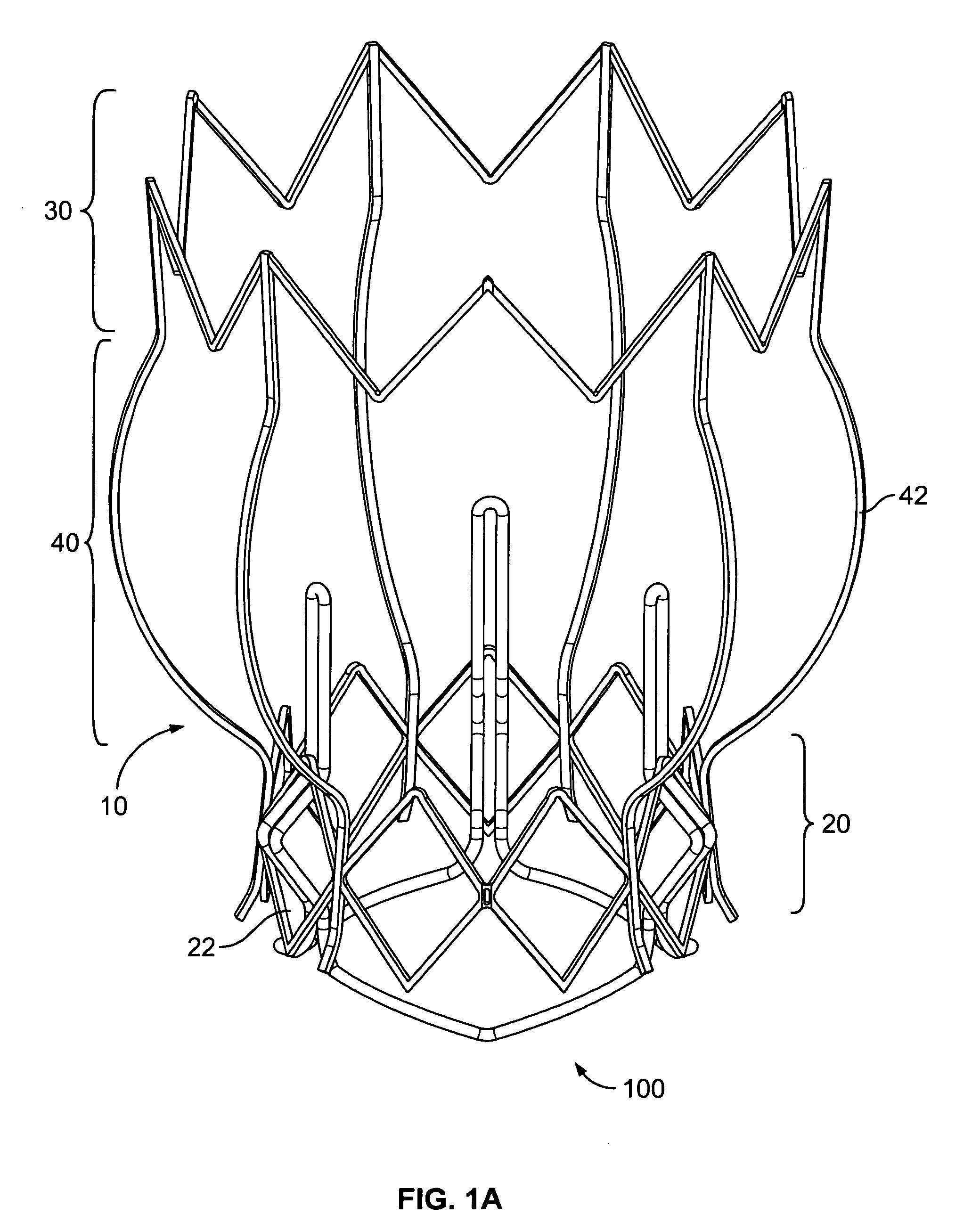 Two-stage collapsible/expandable prosthetic heart valves and anchoring systems
