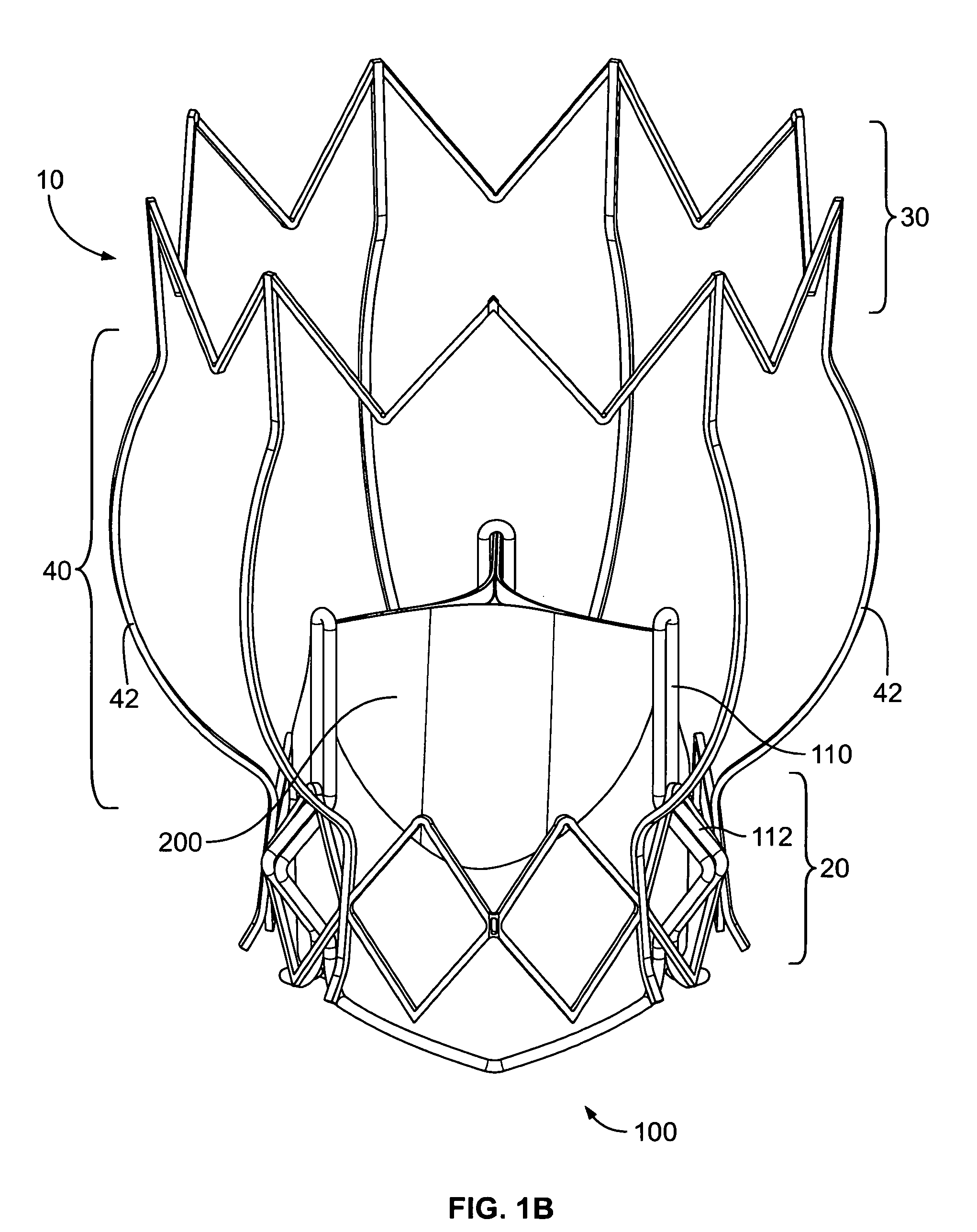 Two-stage collapsible/expandable prosthetic heart valves and anchoring systems
