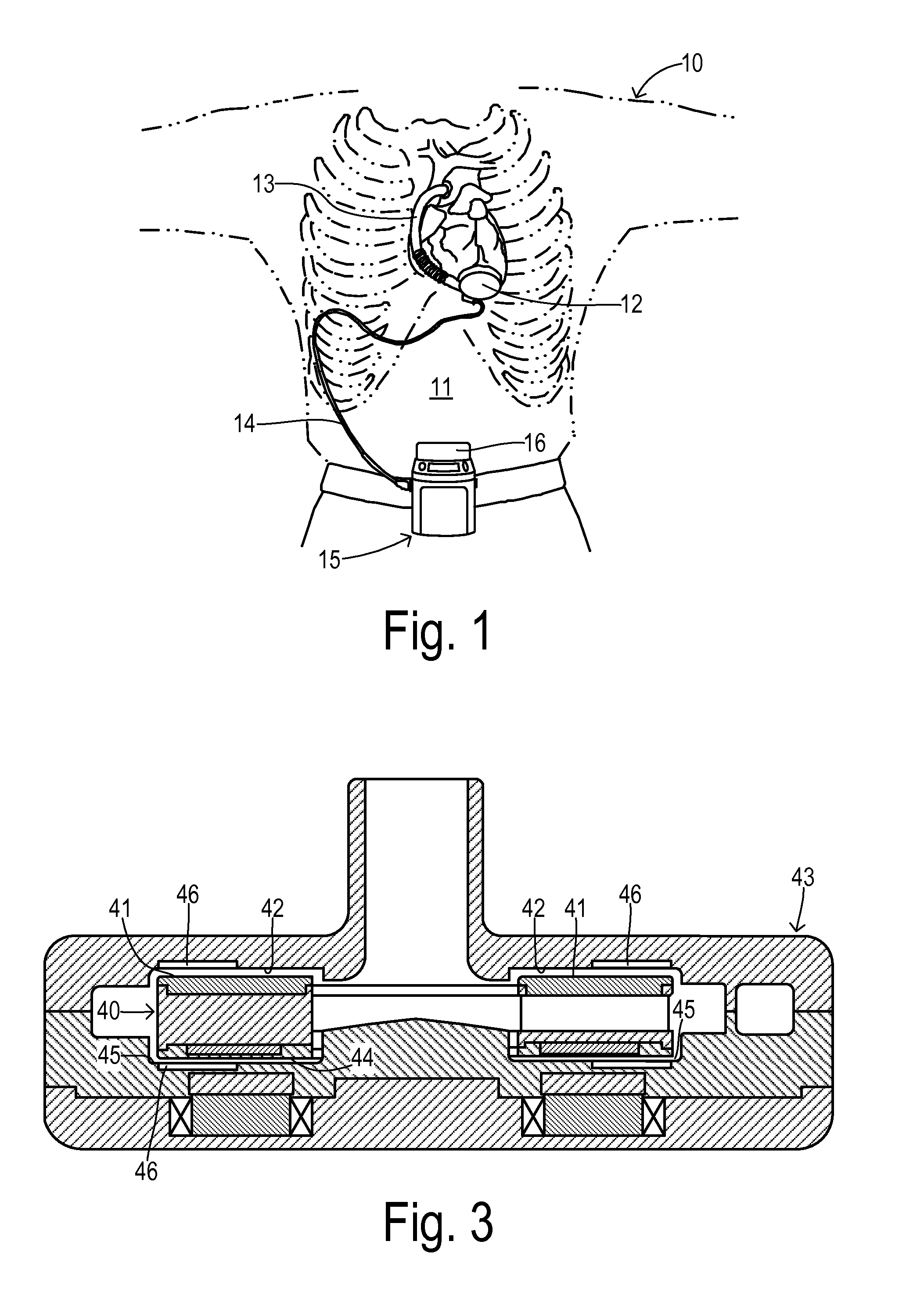 Rotary pump with levitated impeller having thrust bearing for improved startup