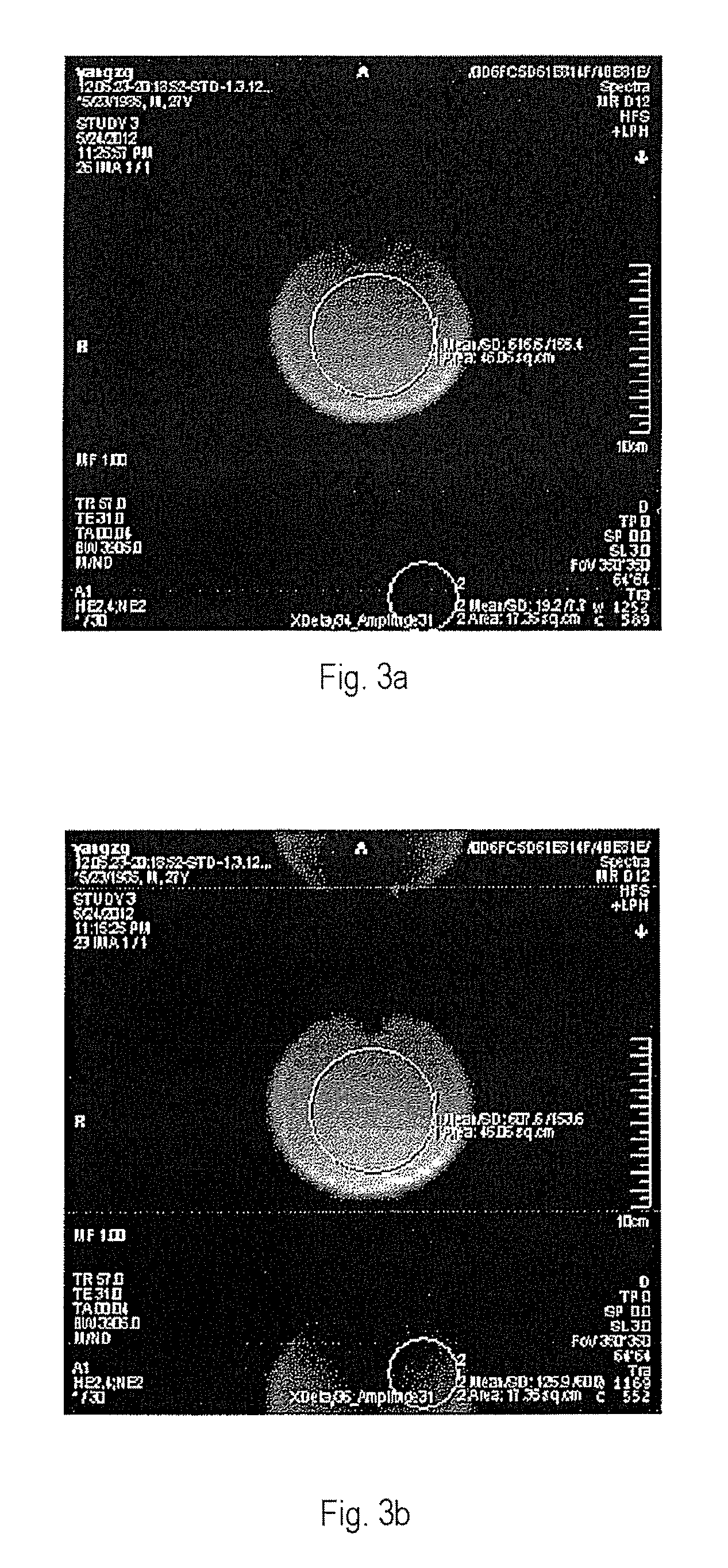 Method and apparatus for compensating for gradient delay in magnetic resonance scanning sequence