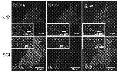 Anti-repulsive guidance molecule a (RGMA) antagonistic antibodies for treating spinal cord injury and pain