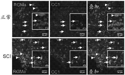 Anti-repulsive guidance molecule a (RGMA) antagonistic antibodies for treating spinal cord injury and pain