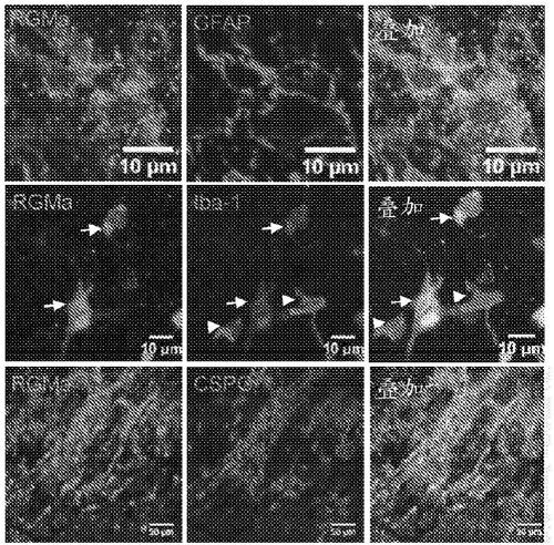 Anti-repulsive guidance molecule a (RGMA) antagonistic antibodies for treating spinal cord injury and pain