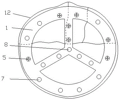 Low-profile peri-locking circular patellar setting fixator