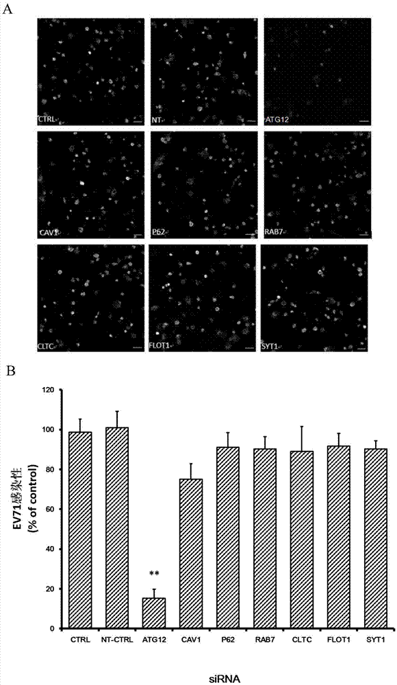 Applications of autophagy-related protein 12 in preventing and treating enterovirus 71 infection