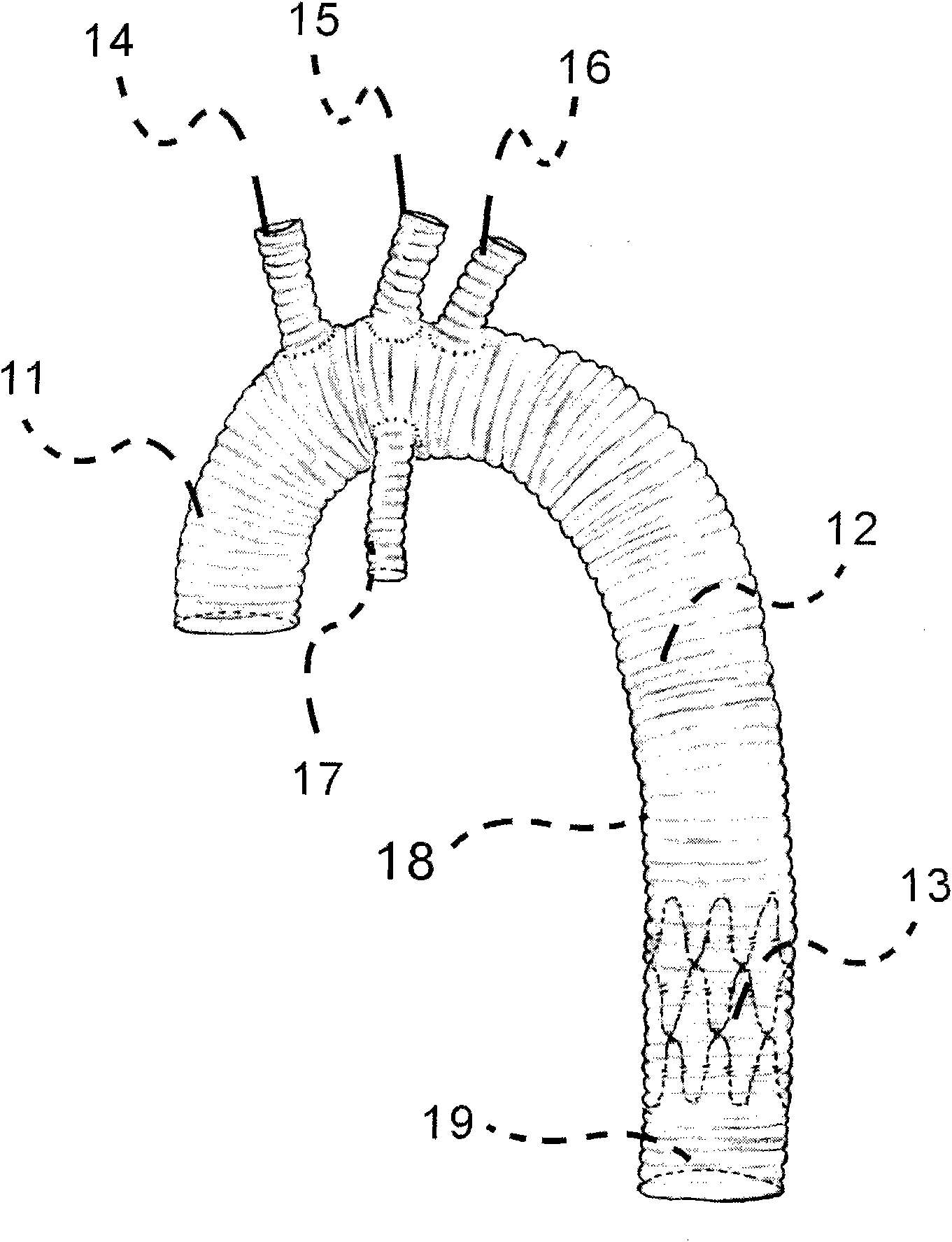 Artificial four-branch blood vessel stented elephant trunk and fixing device thereof