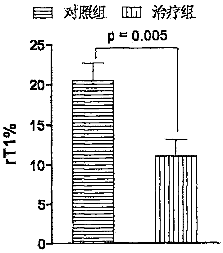 Application of ribavirin in preparing medicine for treating ischemic cerebral apoplexy