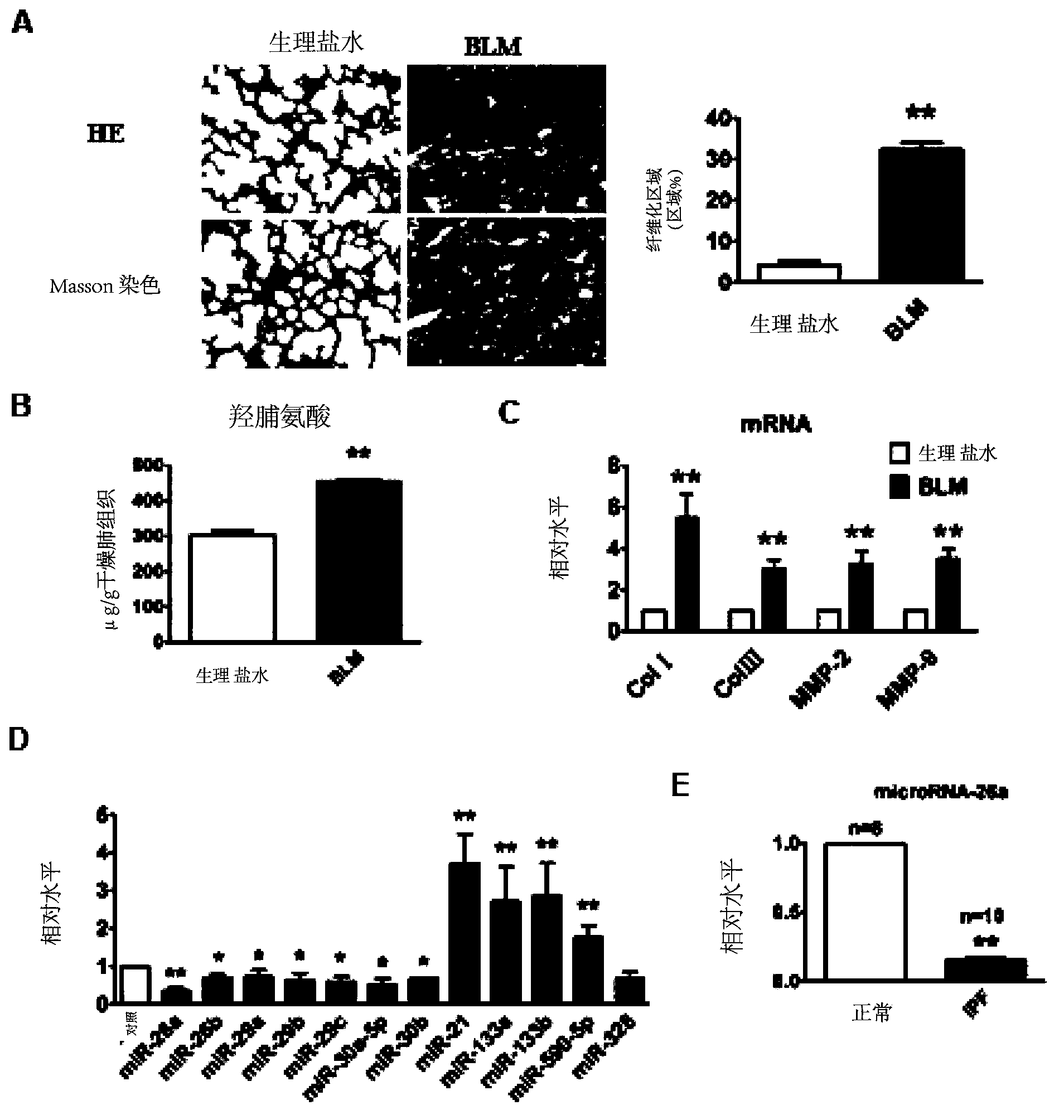 Application of microRNA-26a in preparation of drug for prevention or treatment of pulmonary fibrosis