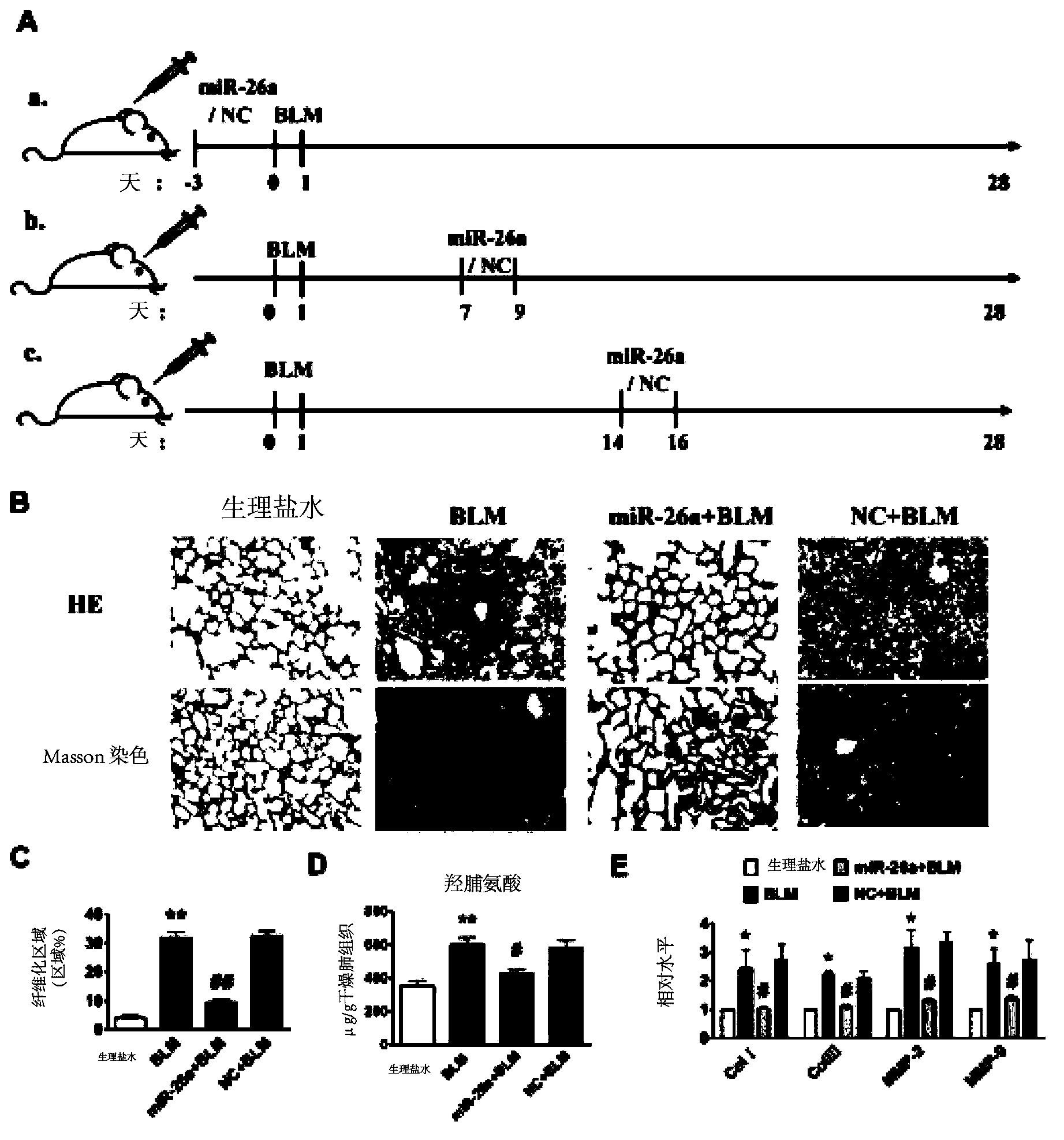 Application of microRNA-26a in preparation of drug for prevention or treatment of pulmonary fibrosis