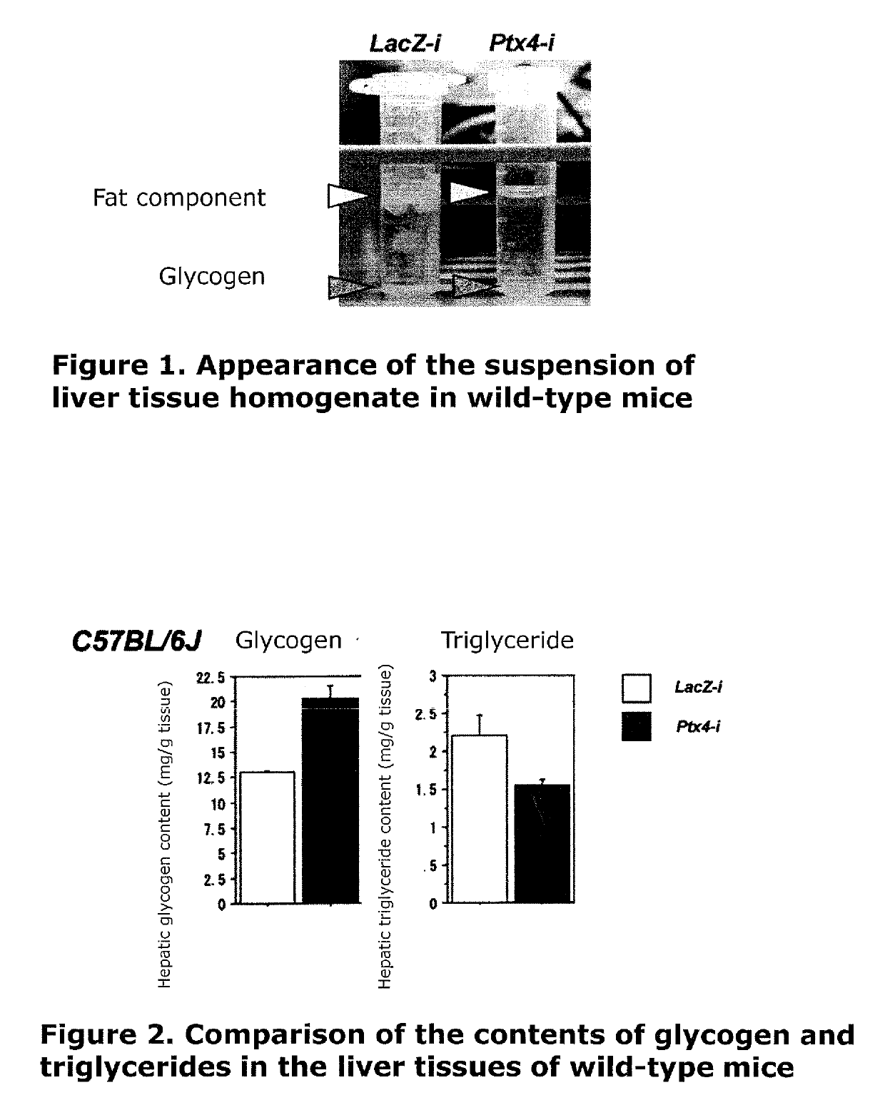 Obesity-related disease therapeutic agent by hepatic secretory metabolic regulator inhibitory action