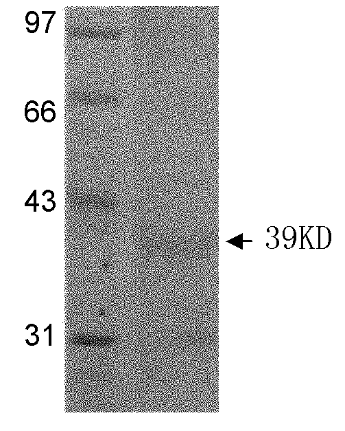 Japanese blood fluke protein and application thereof
