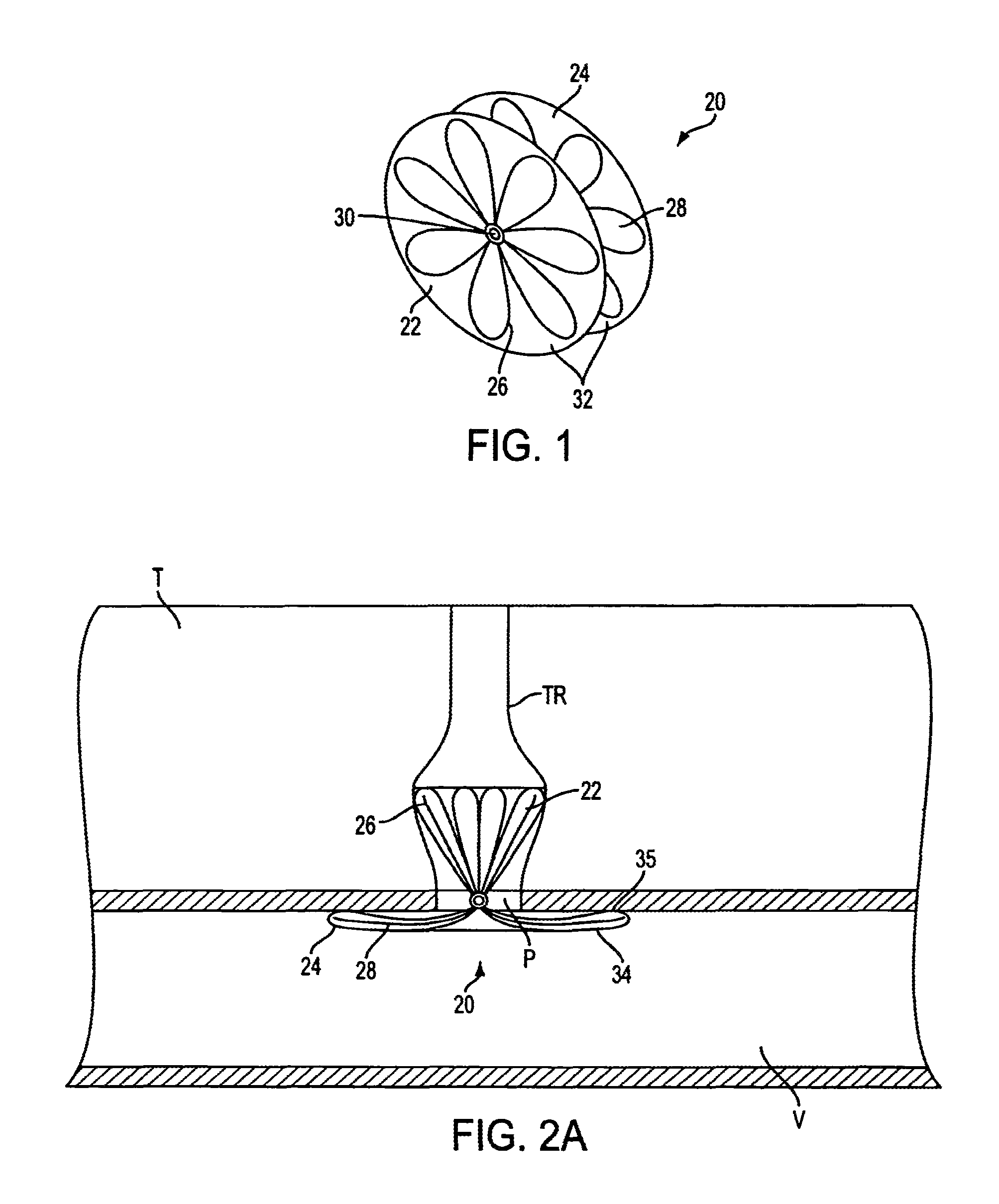 Apparatus for sealing surgical punctures