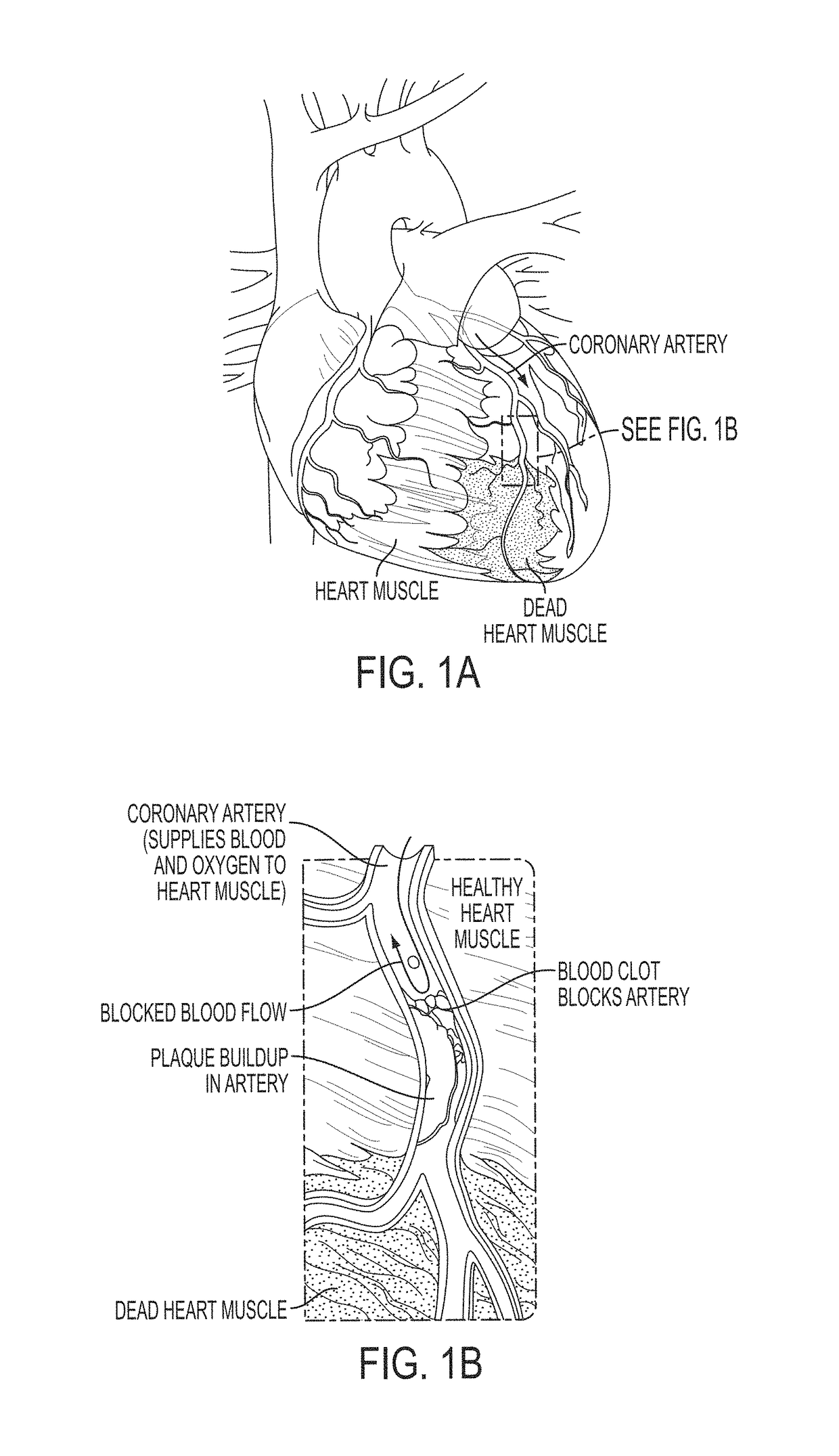 Method and system for multi-scale anatomical and functional modeling of coronary circulation
