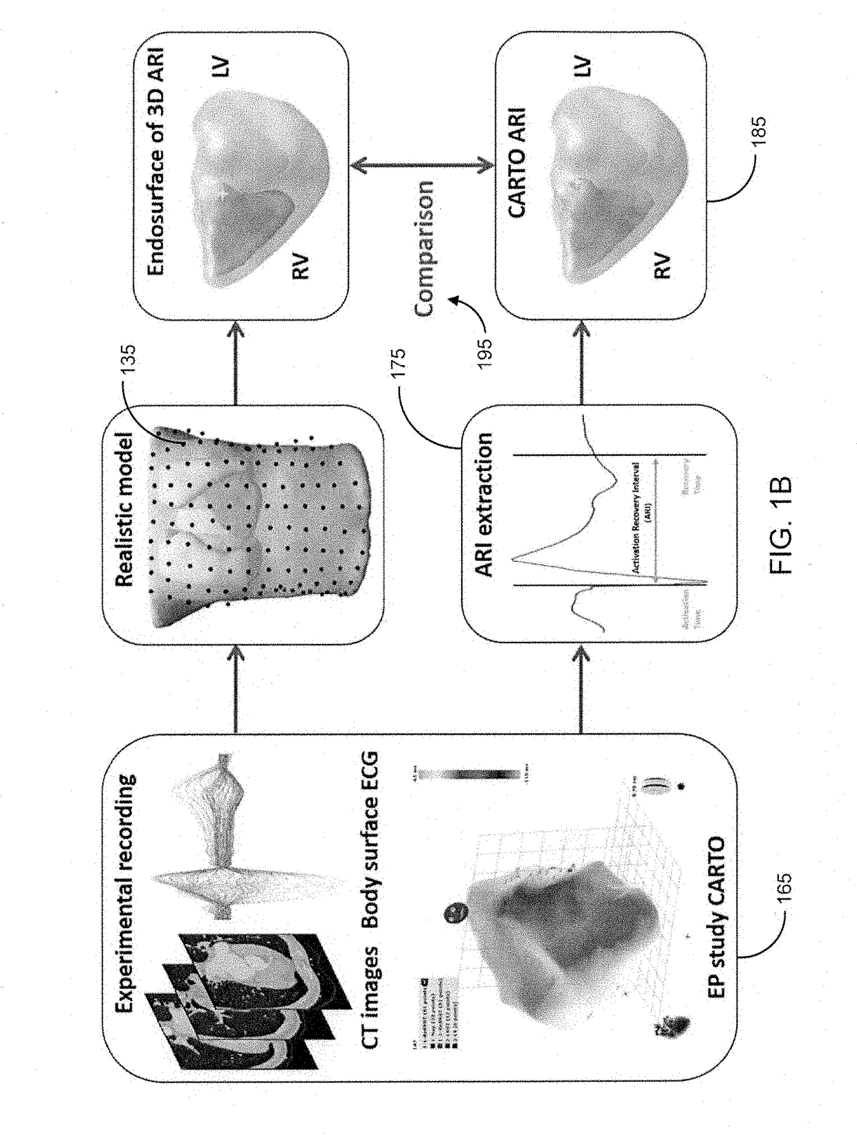 System and method for activation recovery interval imaging of cardiac disorders