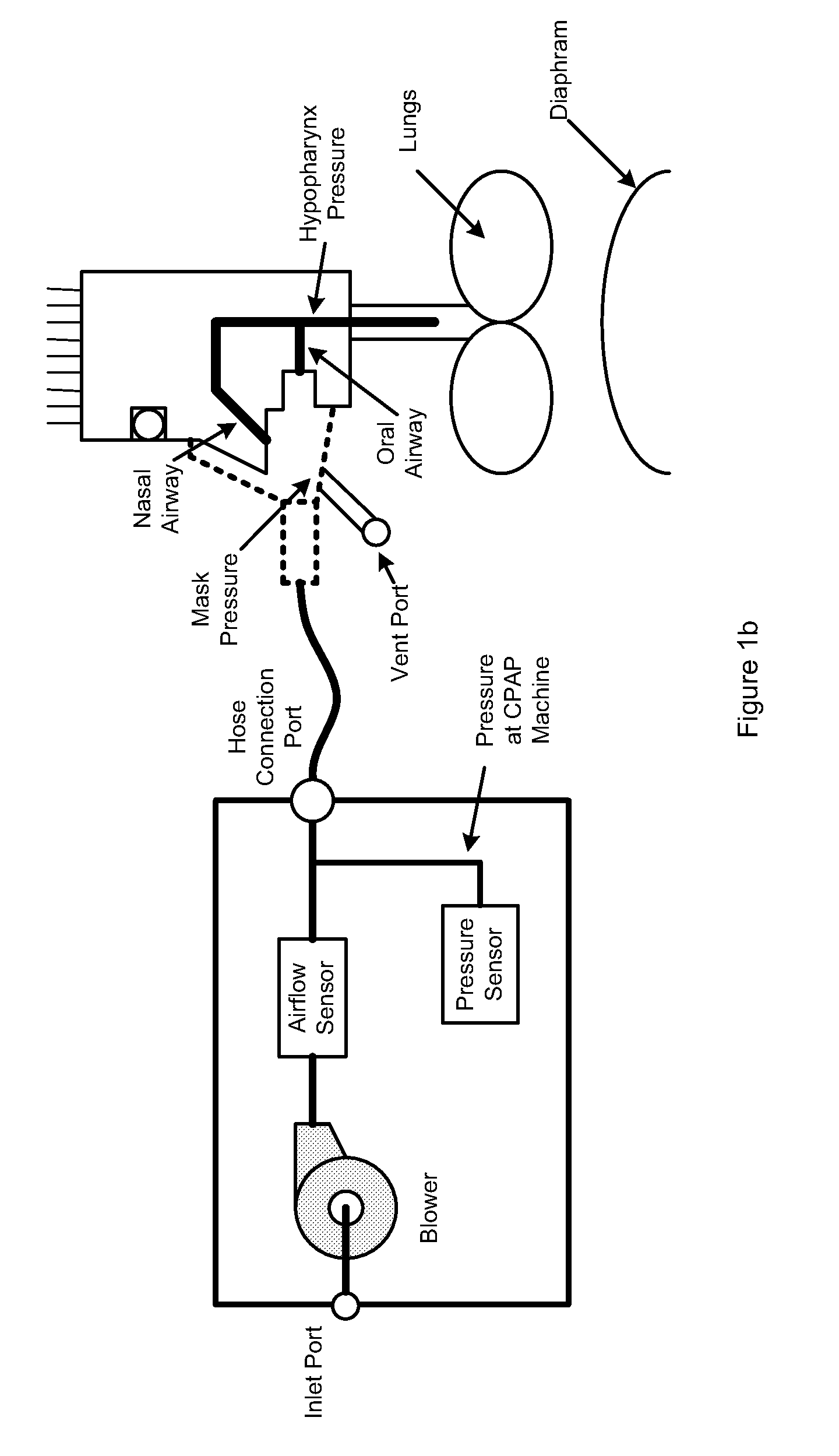 Positive Airway Pressure System and Method
