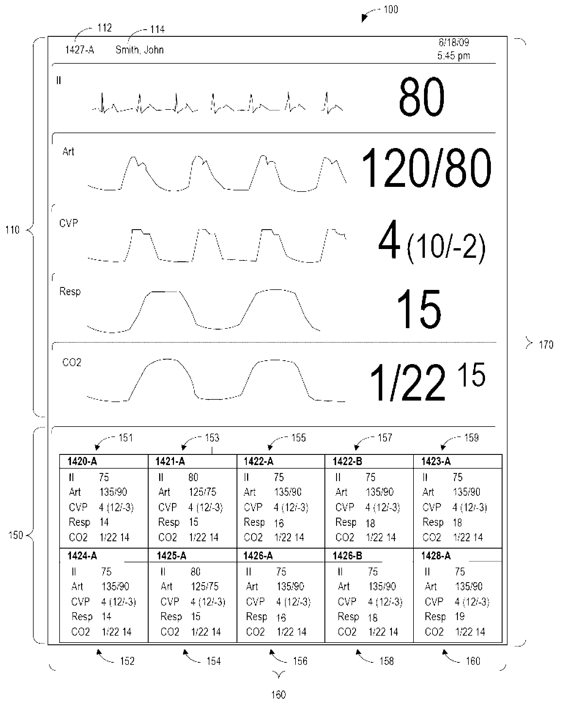 Systems and methods for remote monitoring