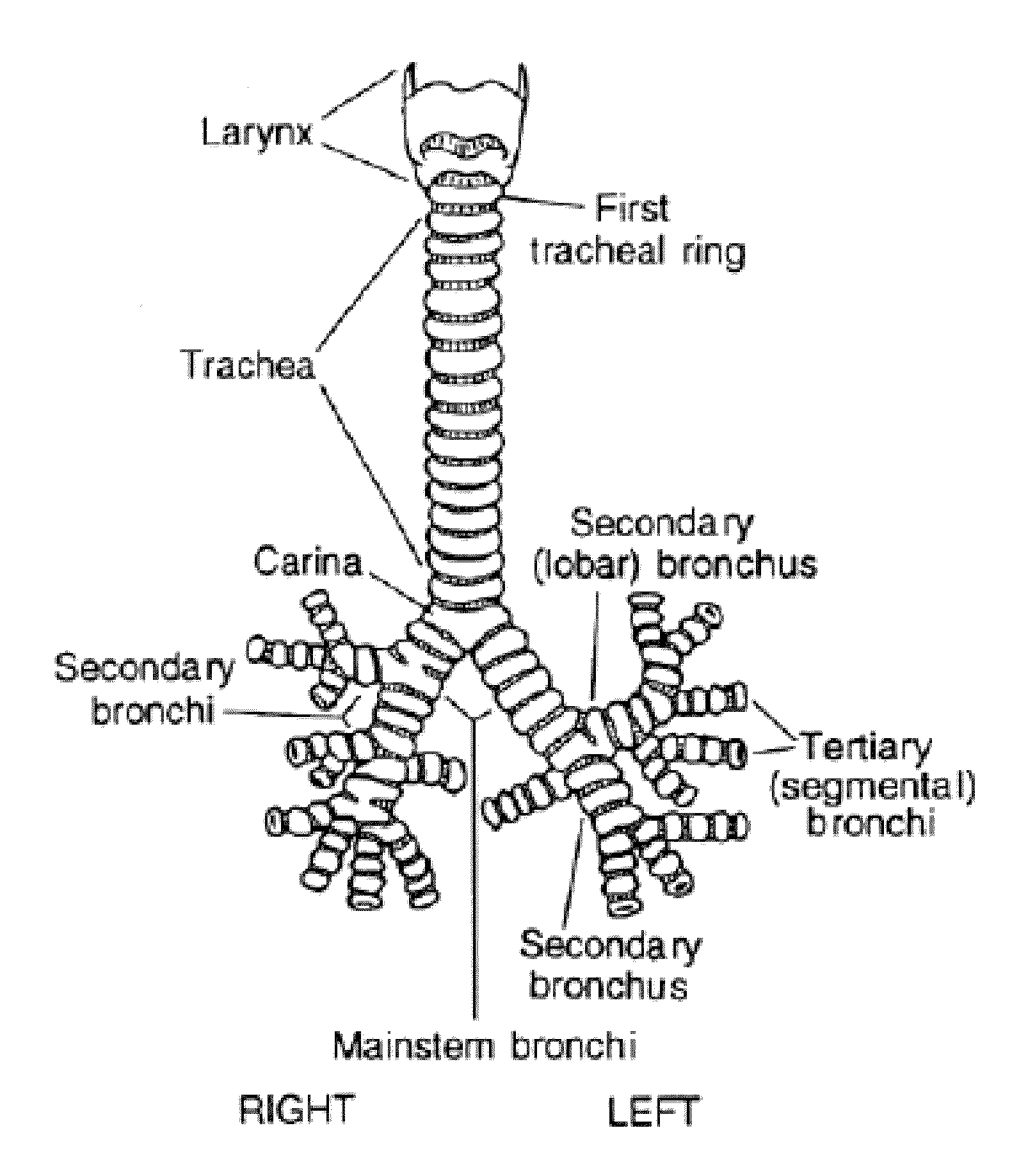 System for manufacturing fiber scaffolds for use in tracheal prostheses